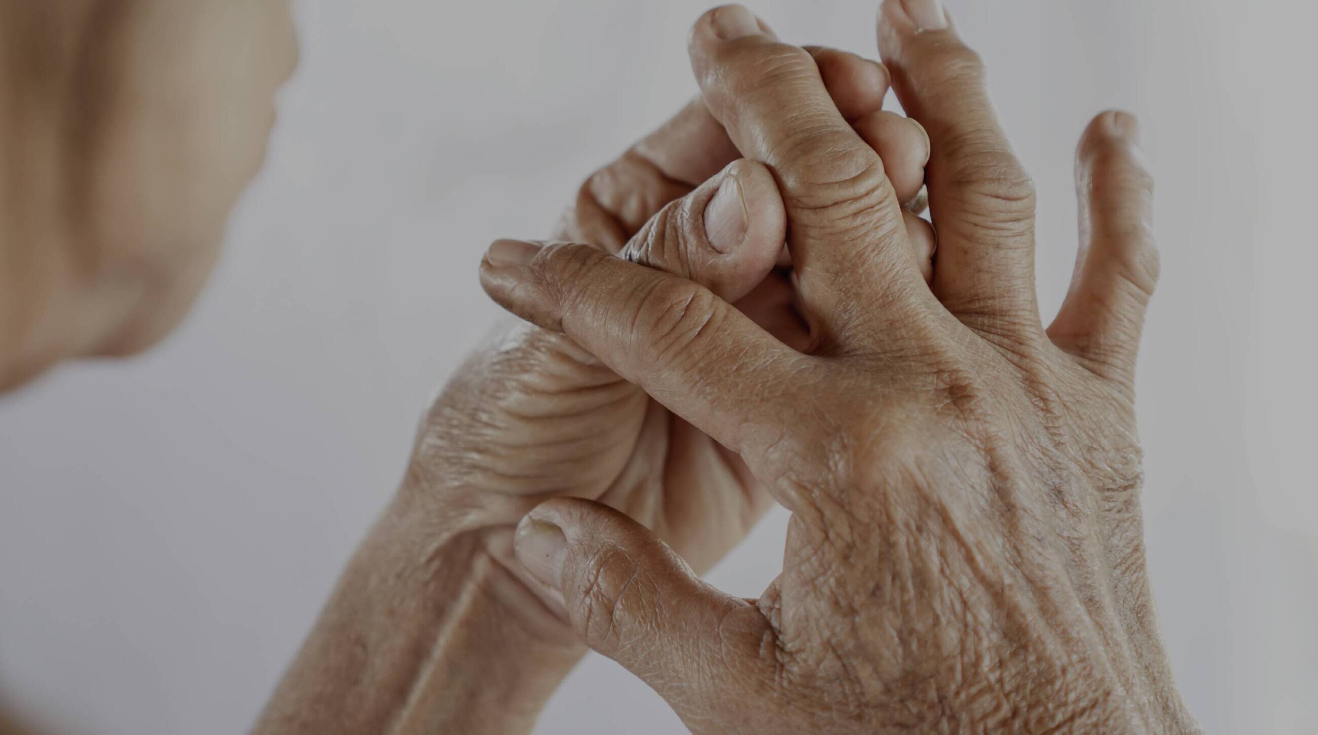ARTRITIS Y ESTRÉS POSTRAUMÁTICO