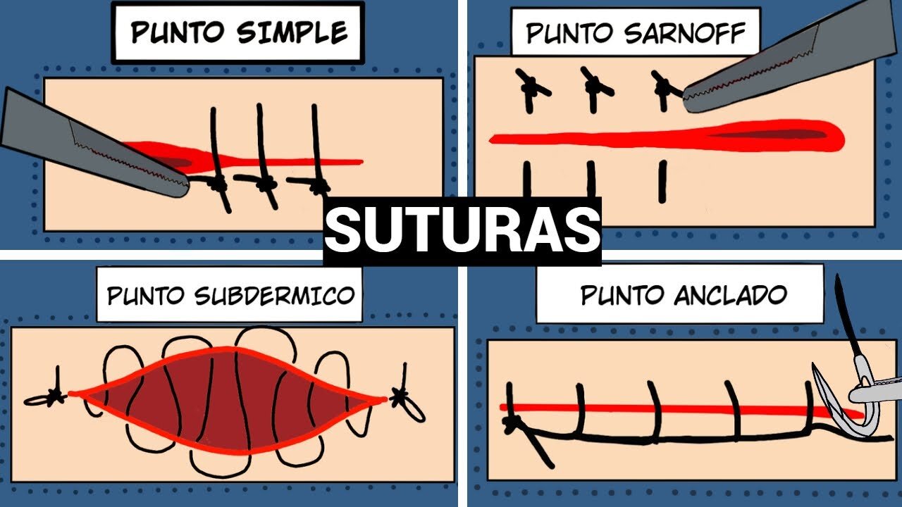 Sutura